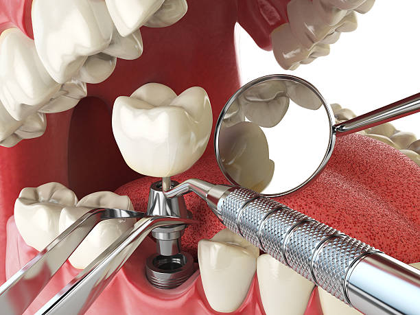 Best Holiday Emergency Dentist in Robinson, IL