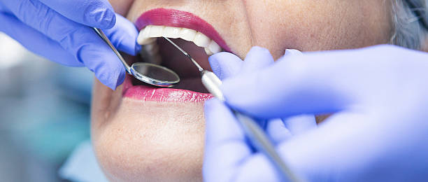 Best Emergency Root Canal Treatment in Robinson, IL