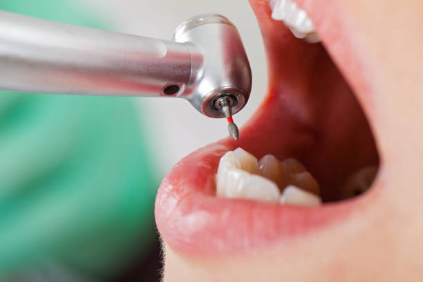 Best Pediatric Emergency Dentist in Robinson, IL